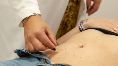 Inserimento di aghi sottili sull’addome durante un trattamento di agopuntura.